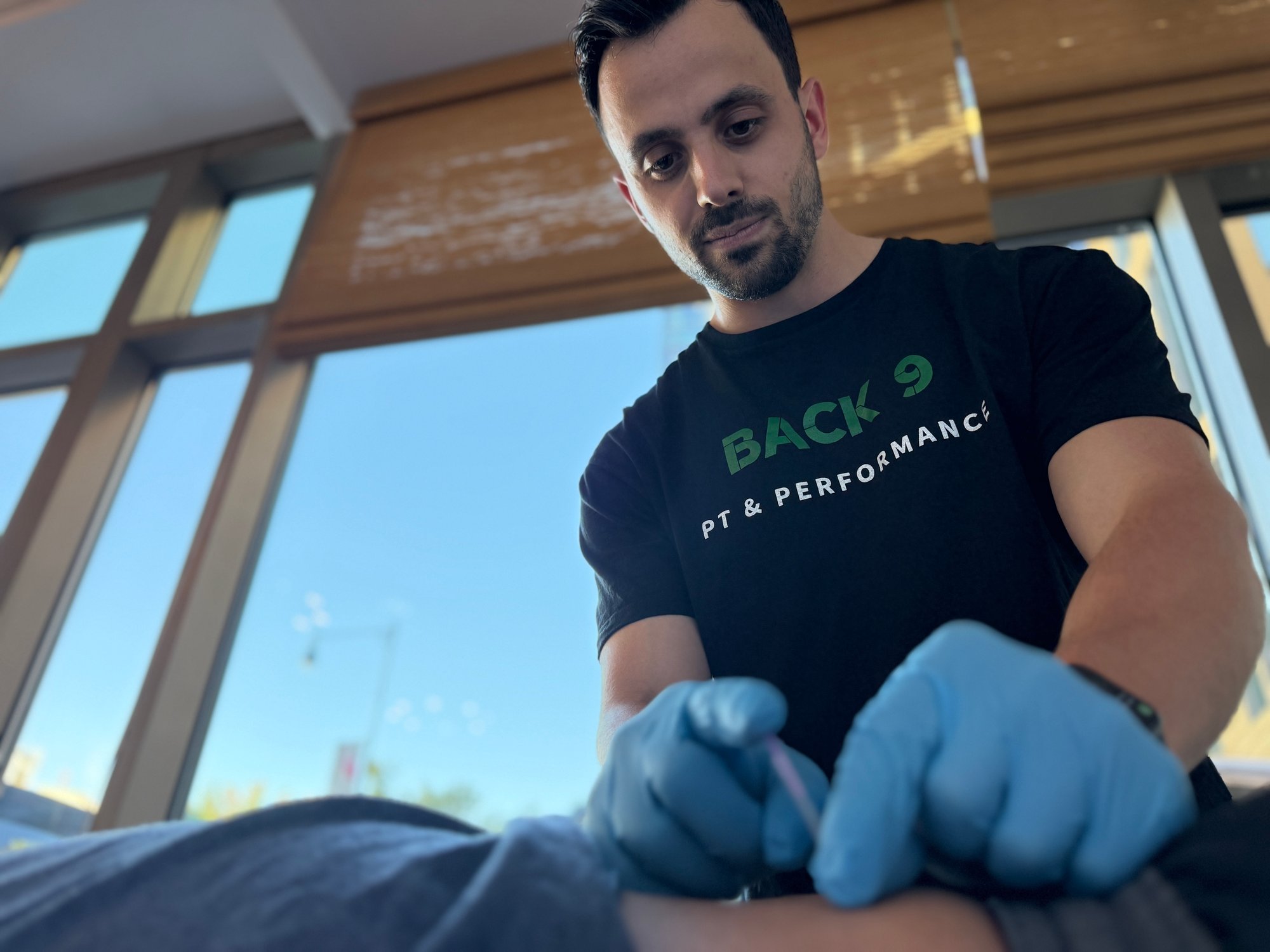 physical-therapy-dry-needling-cambridge 3